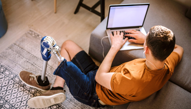 man with prosthetic leg on laptop