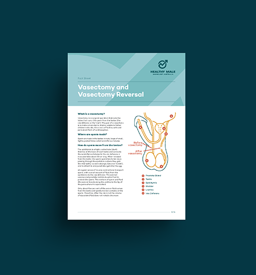 Vasectomy and Vasectomy Reversal Fact Sheet Tile Image